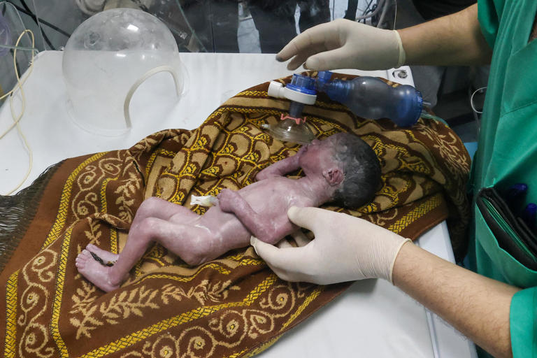 A Palestinian doctor tends to a baby born prematurely after his mother was injured during Israeli bombardment, at the Kuwait Hospital in Rafah, on the southern Gaza Strip on April 20, 2024. / Credit: MOHAMMED ABED/AFP via Getty Images