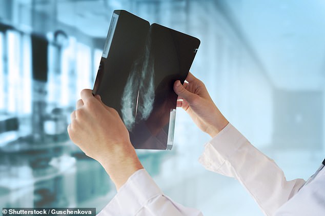 breast cancer survivors at greater risk of new tumours than others