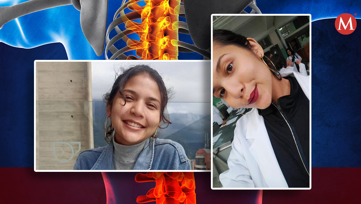 estudiante de 22 años que estudia medicina revela como descubrió que tenía esclerosis múltiple