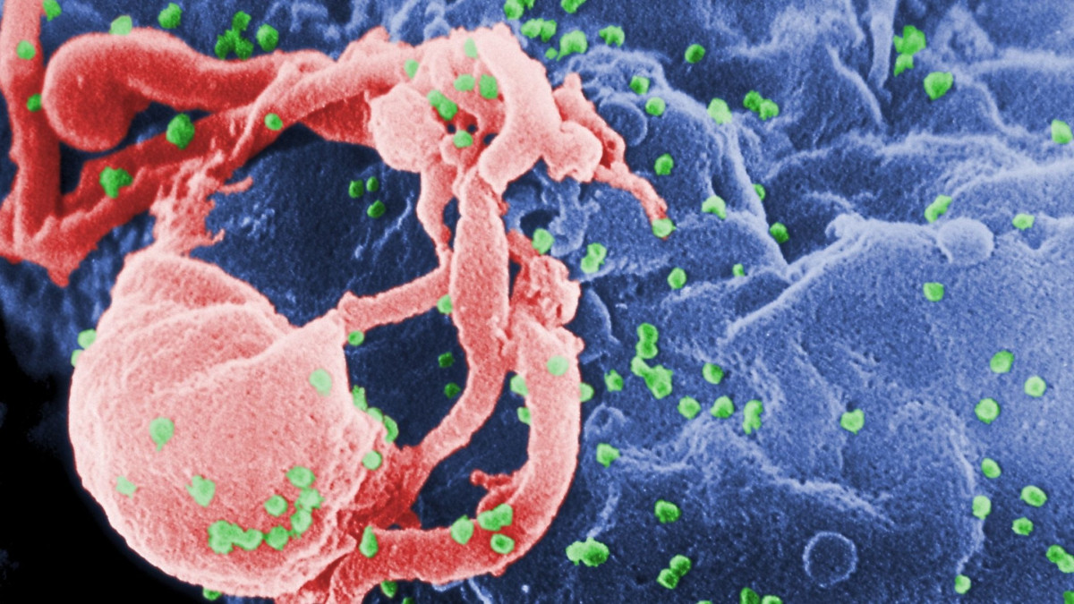 cdc: στο μεξικό το πρώτο περιστατικό μόλυνσης hiv από βελόνες αισθητικής