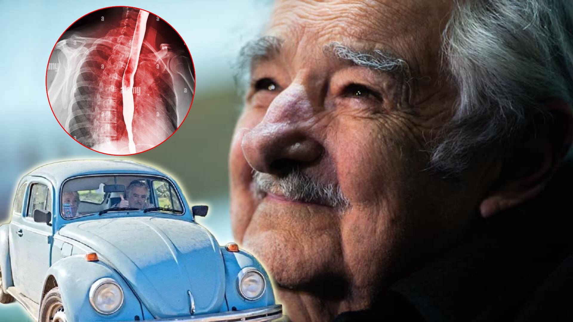 Pepe Mujica Anuncia Que Tiene Tumor En El Esófago Y Cáncer; Conmueve ...