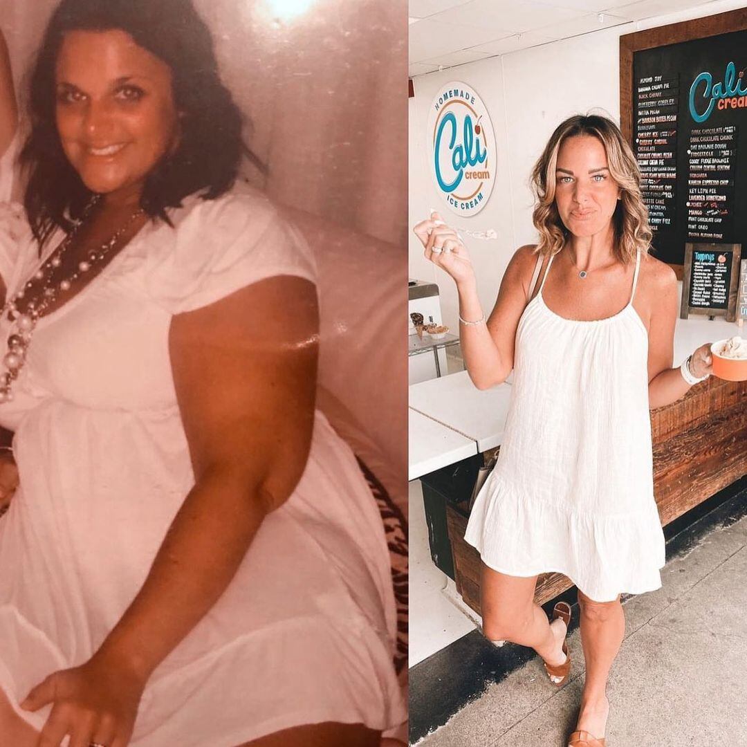 the unspoken truths about life after drastic weight loss