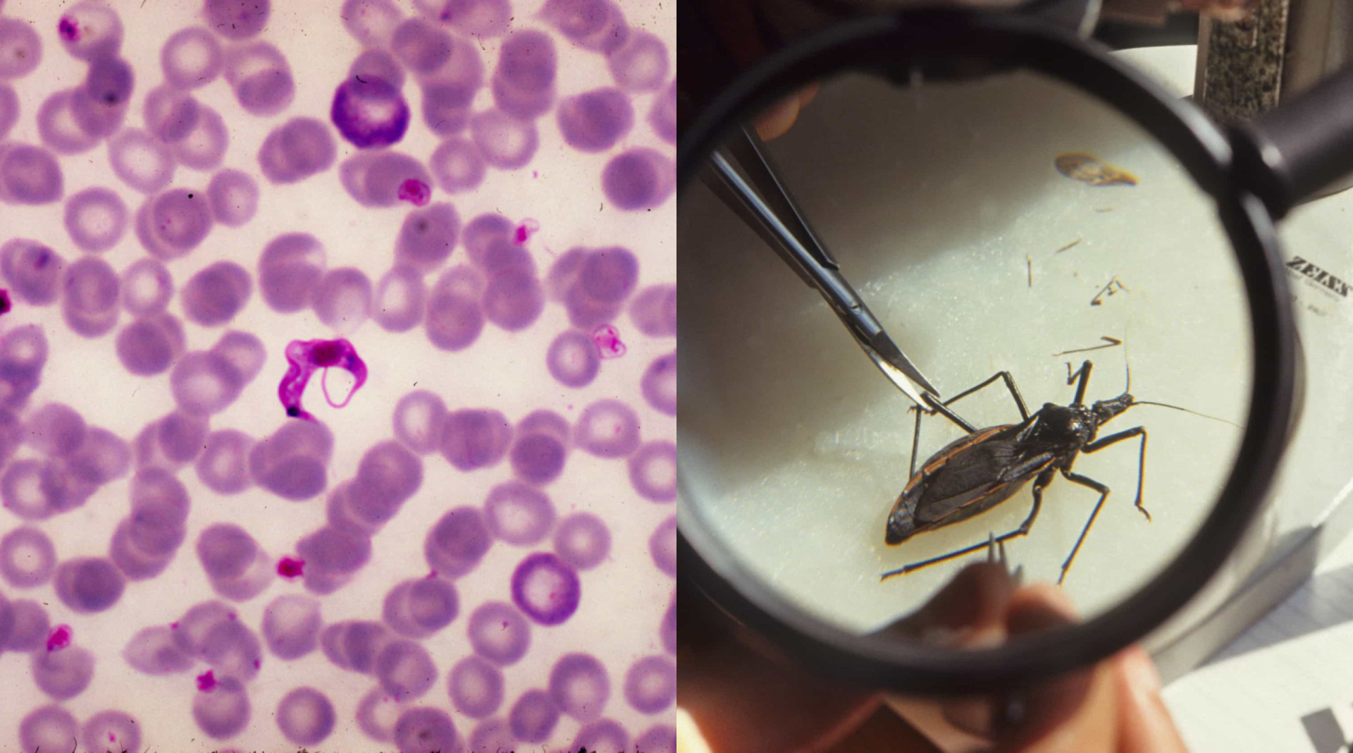 Chagas Disease The Parasite That Lurks For Decades