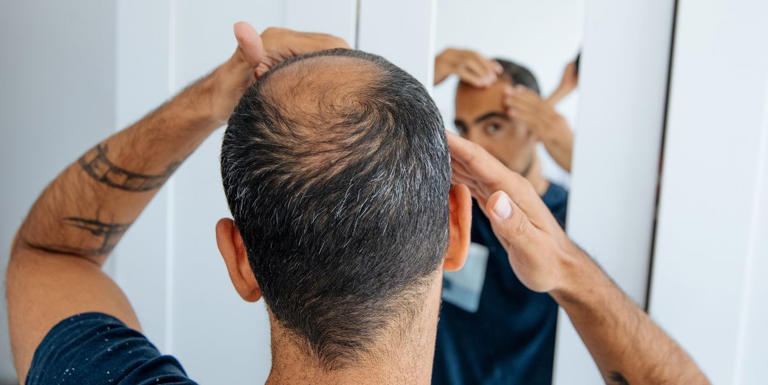 Does Finasteride Cause Side Effects? Doctors Explain.