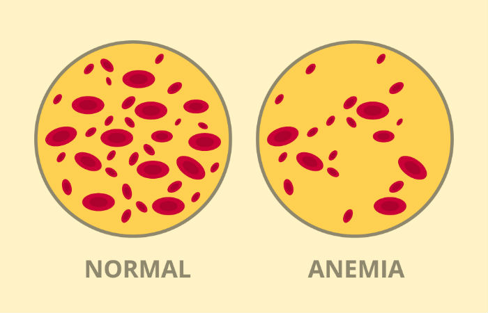 14 Chemo Side Effects Everyone Should Know About