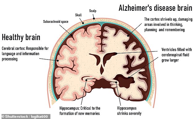 experts reveal how reading fiction can prevent alzheimer's