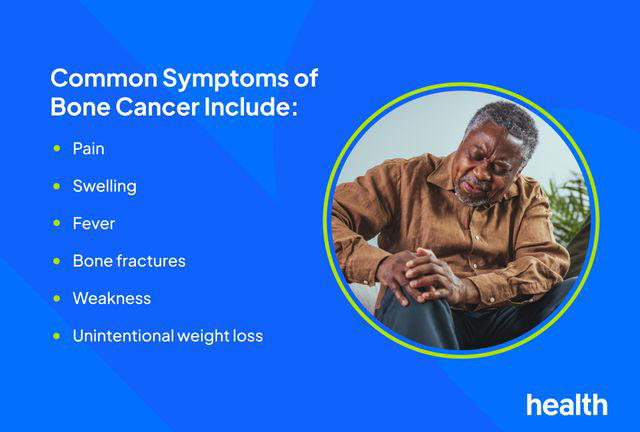 Signs and Symptoms of Bone Cancer