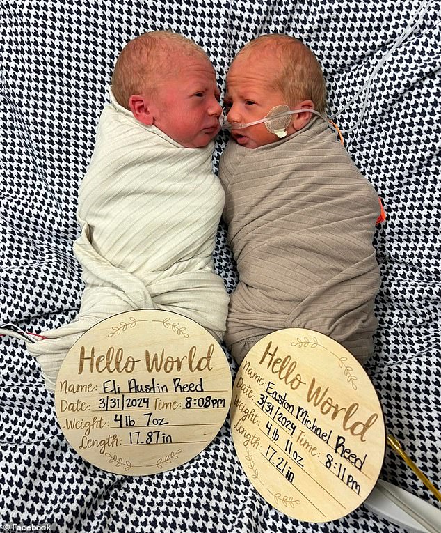 newborn twins fighting rare genetic disease costing $4million to treat