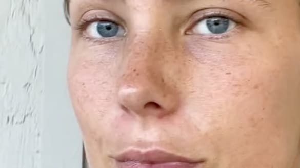 «bleib aus der sonne»: tiktokerin zeigt sich ungeschminkt – und erntet shitstorm