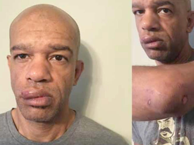 Black undercover police officer beaten up by his own colleagues awarded $23.5m