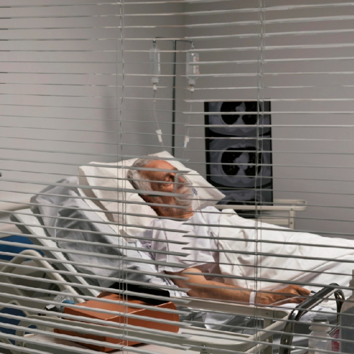 hombre de 72 años estuvo enfermo de covid por 613 días: acumuló 50 mutaciones