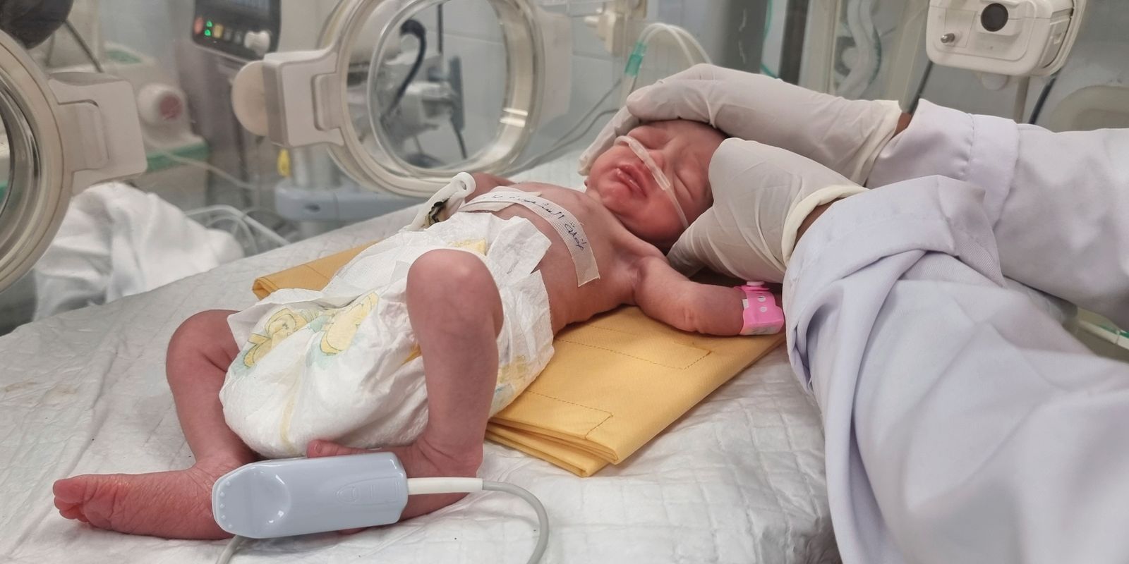 mamma dödad i bombanfall – bebis räddades ur magen