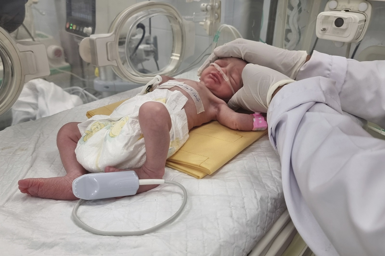 γάζα: πέθανε το κοριτσάκι που είχε γεννηθεί μετά τον θάνατο της μητέρας του