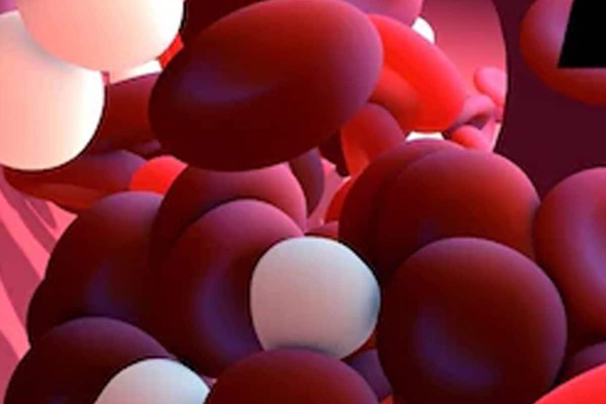what are the symptoms of blood clotting? a look at home remedies to prevent it