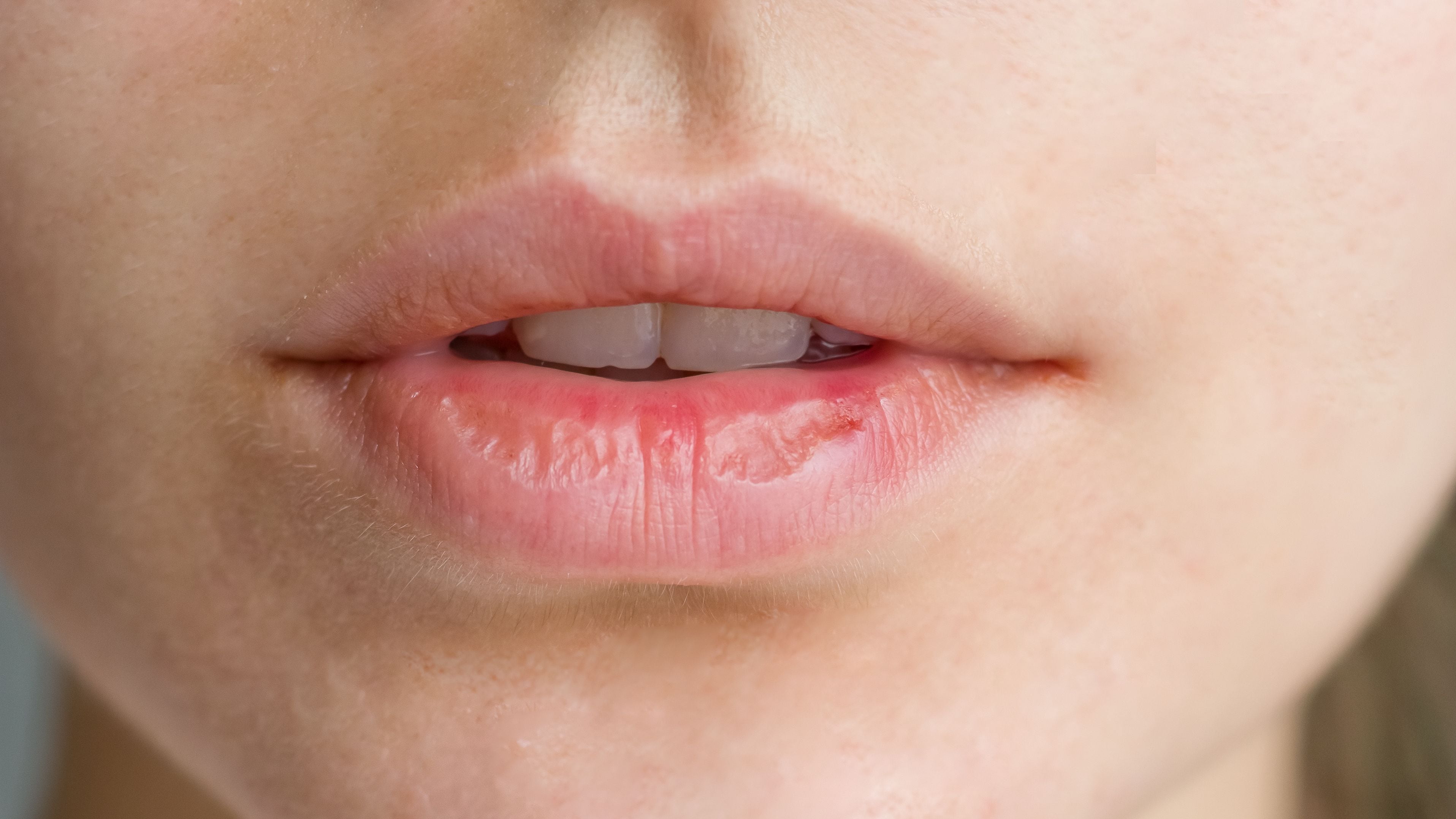 ¡adiós a los labios agrietados!: estas son las 3 formas de mantenerlos hidratados en el invierno