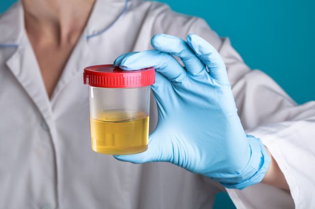 new urine sample study finds little-known toxin in human body: 'raises alarm bells about how it could potentially cause harm'