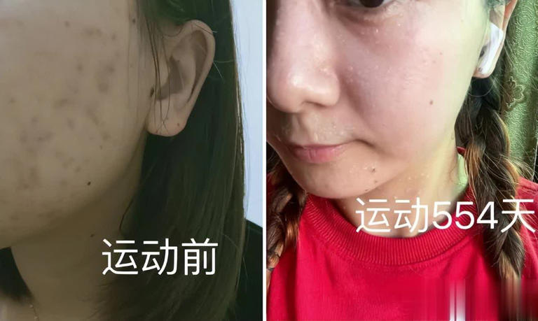 有一种“整容”叫长期运动！看了这几组运动前后对比，效果太惊艳