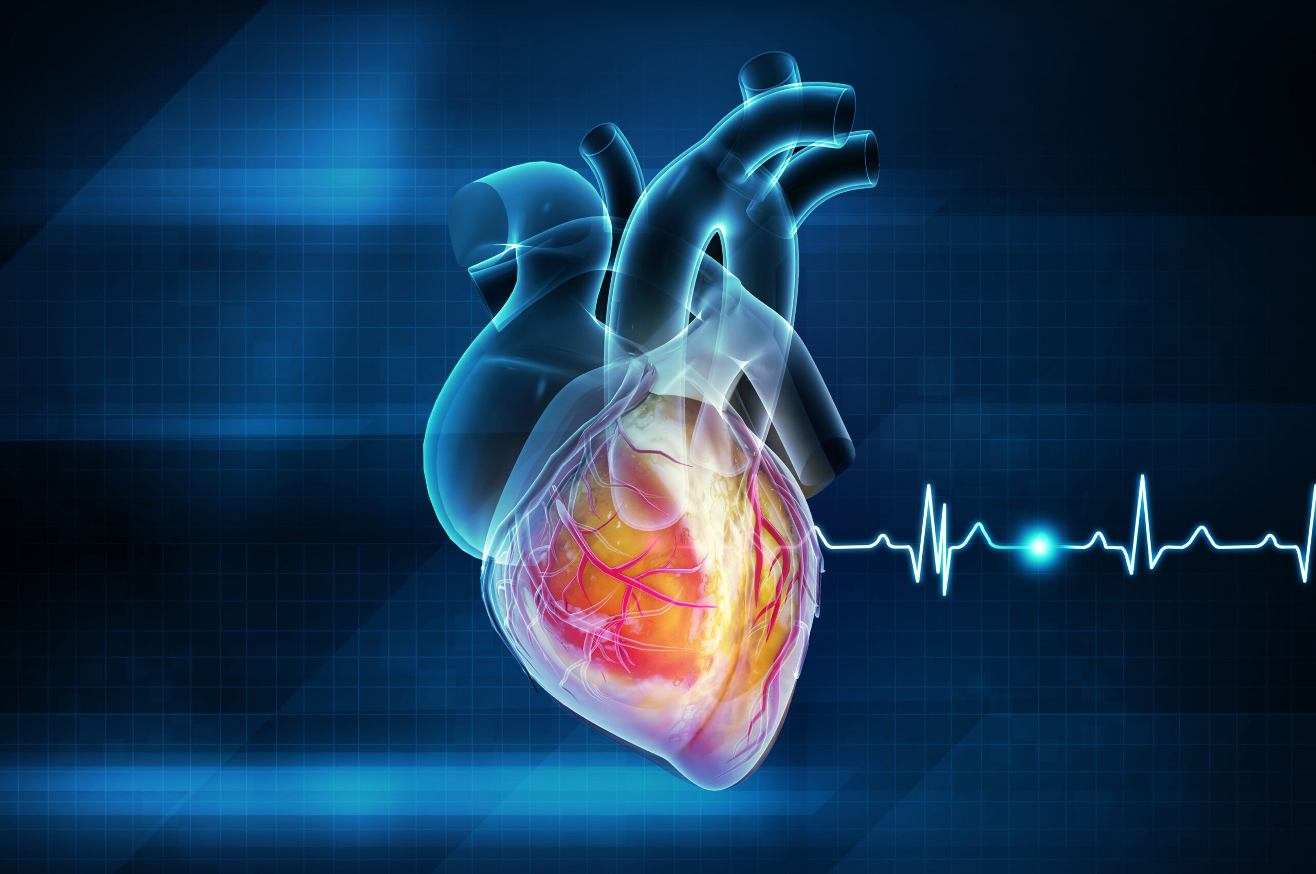 sintomas de infarto pouco conhecidos para você ficar atento