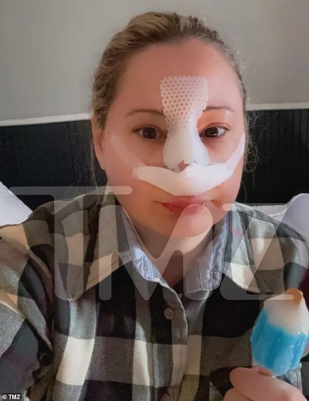 gypsy rose blanchard, 32, shows off new nose after plastic surgery