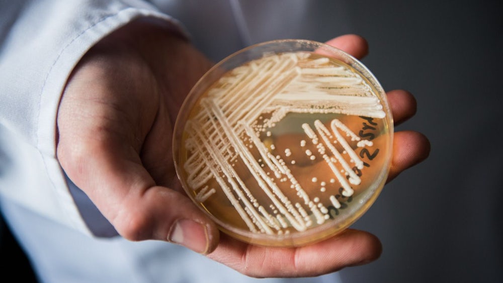 infektionen: forscher warnen: krank machender pilz breitet sich aus