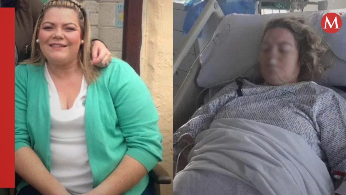 mujer pierde su vaso sanguíneo tras someterse a una cirugía para bajar de peso que tenía descuento