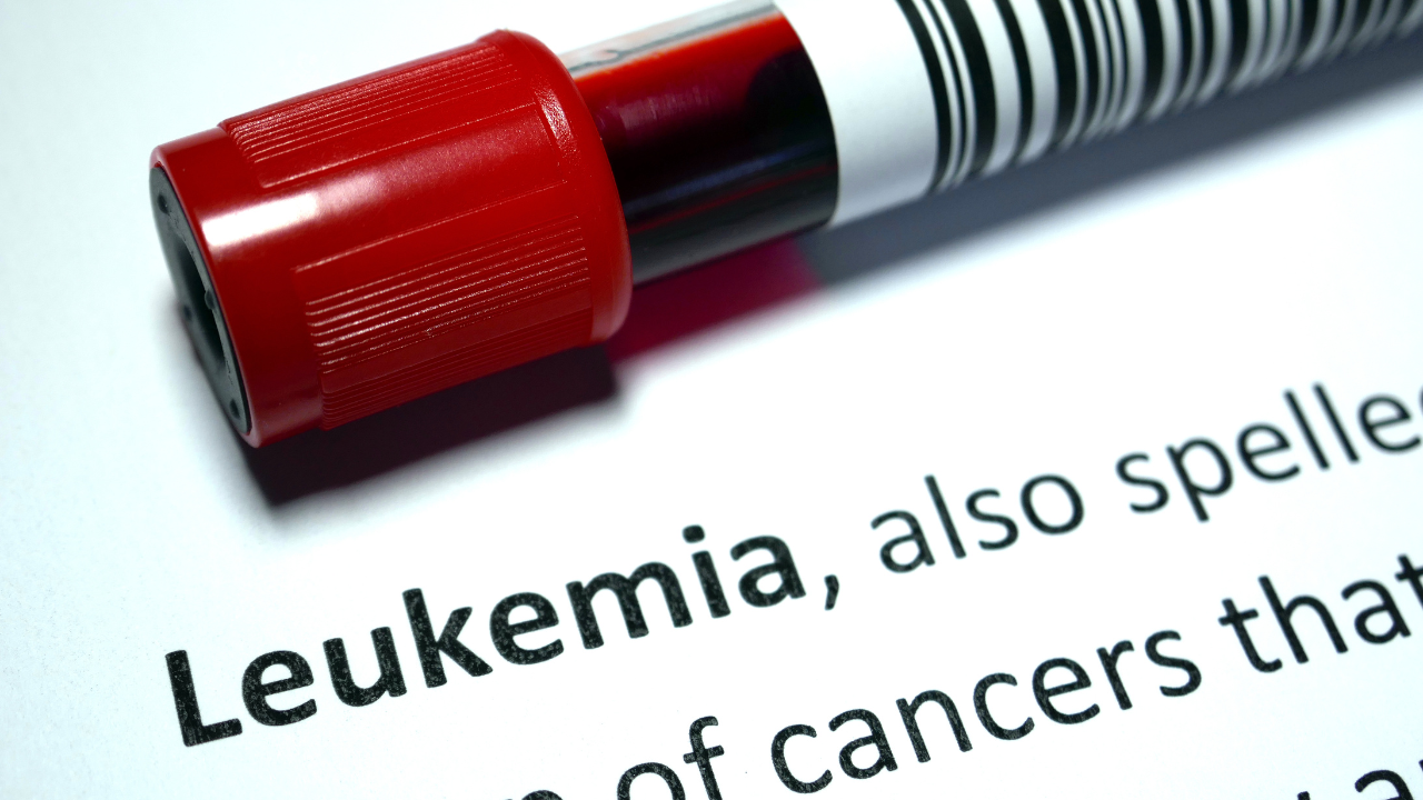 Childhood Leukemia: Causes, Symptoms, And Treatment Of Blood Cancer