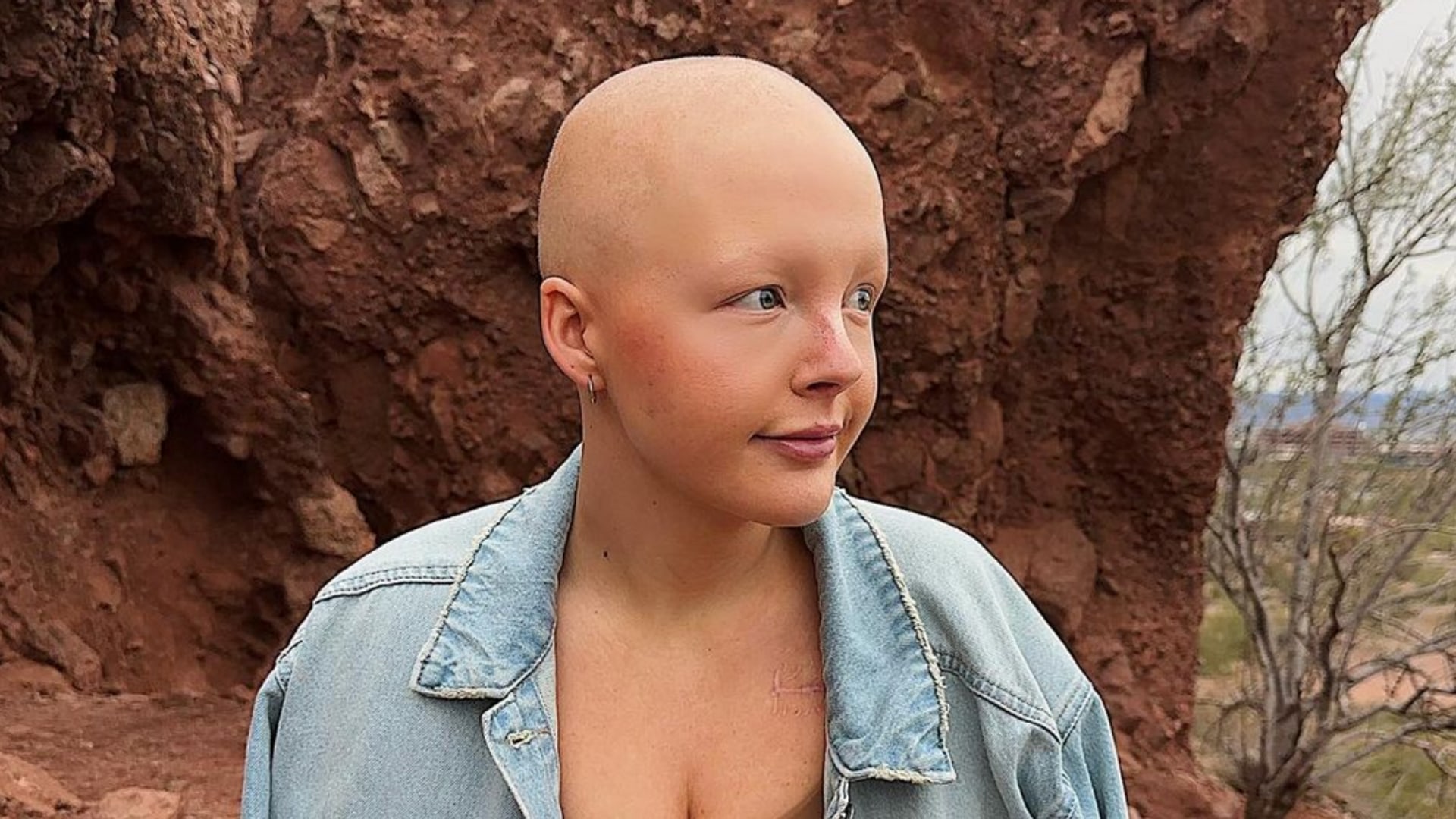 TikToker Maddy Baloy, 26, Dies After Battle With Terminal Cancer ...