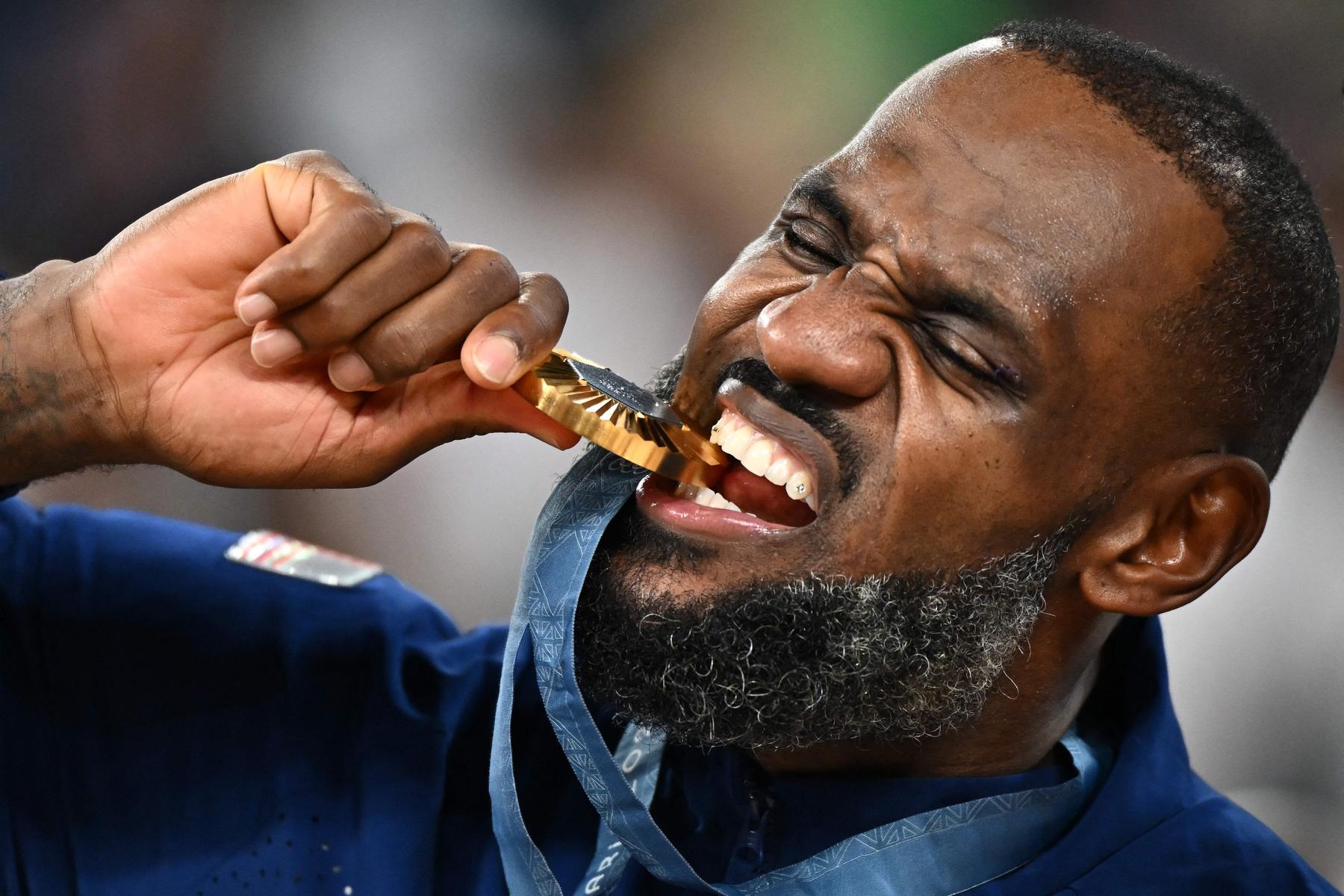 Darum beißen Athleten in ihre Medaille