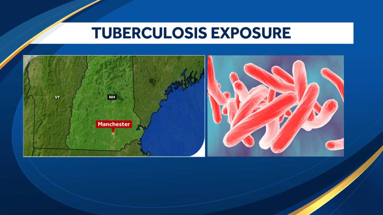 Kids, staff exposed to tuberculosis at New Hampshire child care ...