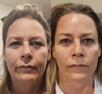 Reviewer before and after showing the mask made their skin look tighter and reduced the appearance of some fine lines