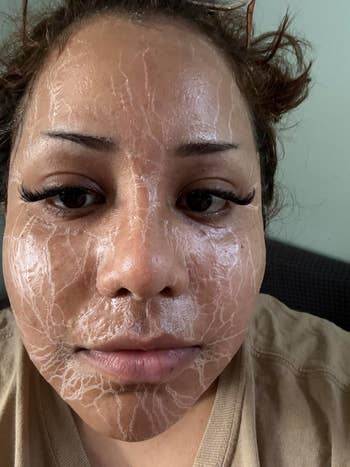 Close-up of a reviewer with a facial treatment mask on showing cracked effect