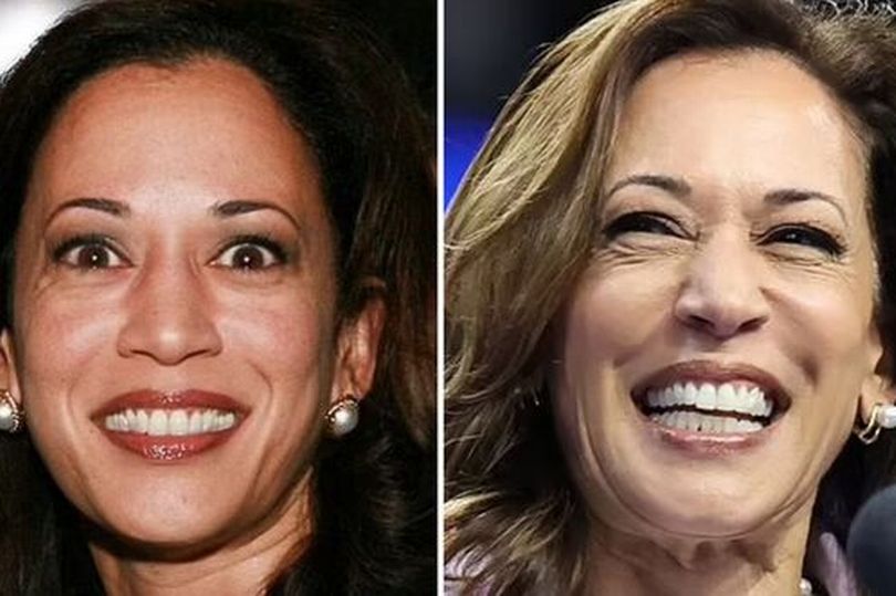 Has Kamala Harris Had Plastic Surgery? Doctor Shares Secret To ...