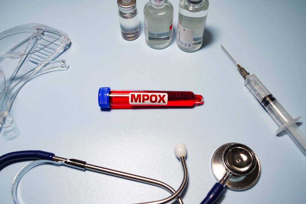 Expert Weighs In On Likelihood Of Lockdown As Mpox Outbreak Spreads