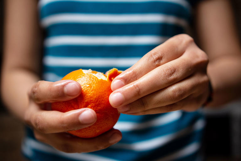Mujer pela mandarina alimentos dañan el hígado riesgo cirrosis
