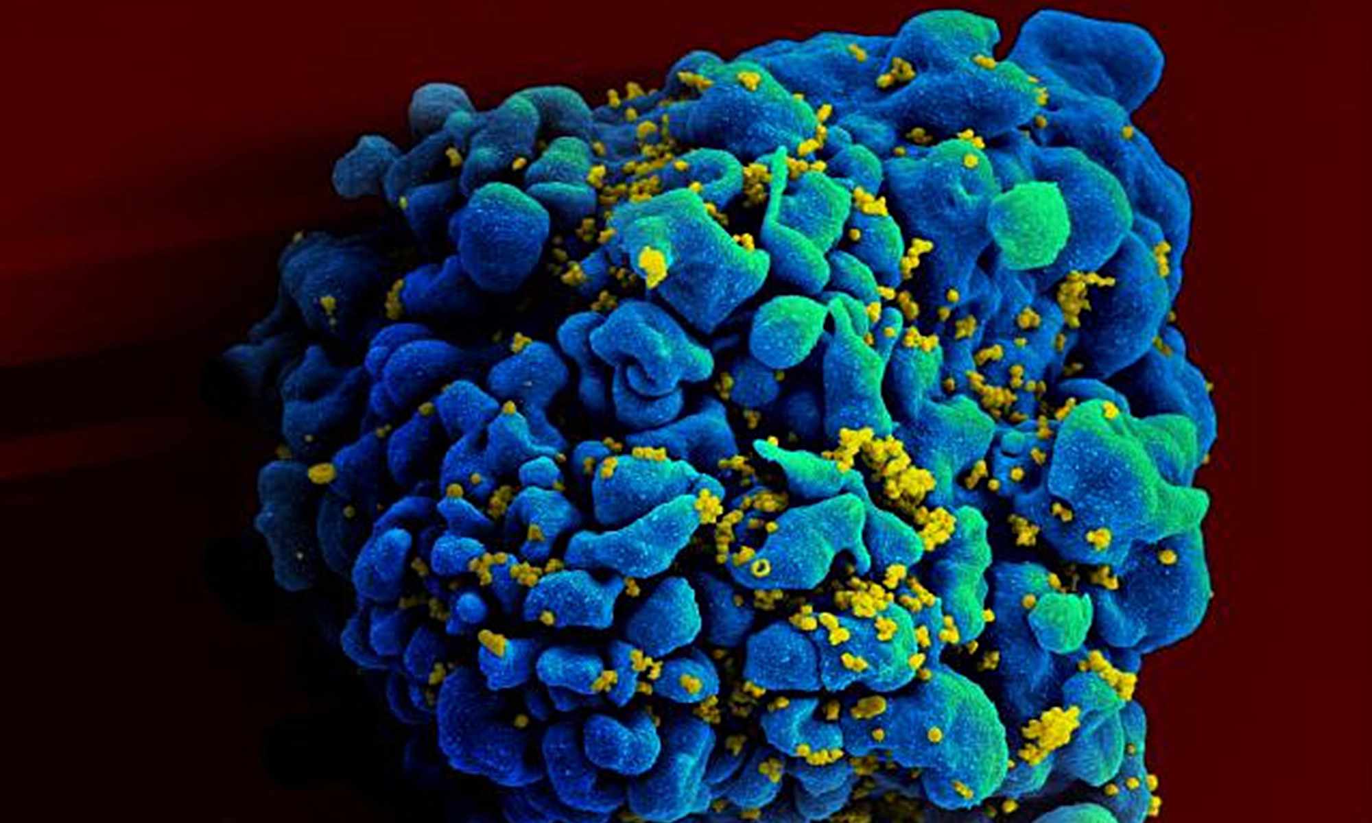 HIV symptoms at each stage
