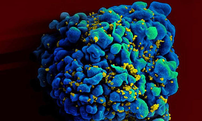 HIV symptoms at each stage