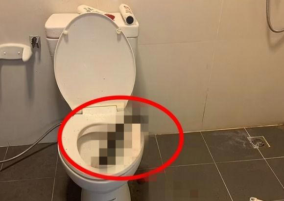 トイレにヘビ 命がけの戦い」トイレ中に体長3.6メートルのニシキヘビに急所を