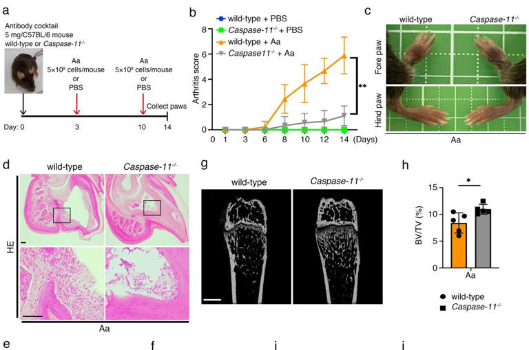 shedding-light-on-how-oral-bacteria-can-aggravate-rheumatoid-arthritis