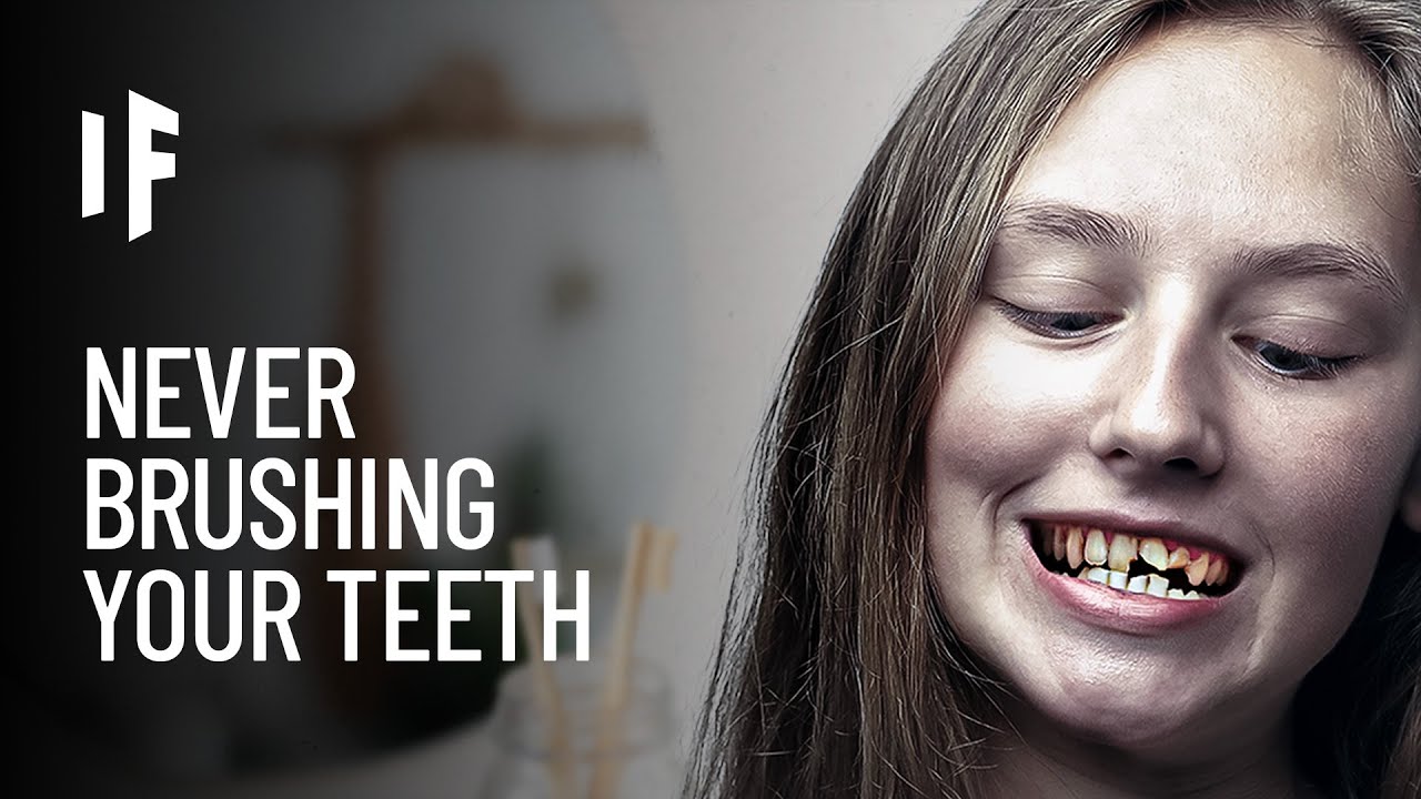 Watch what happens when you stop brushing your teeth