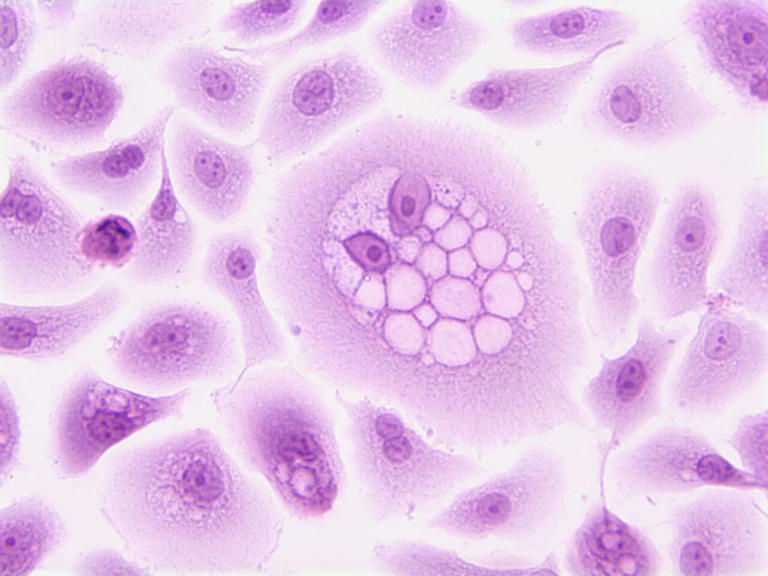 Boosting the cell's own cleanup: New class of small molecules ...