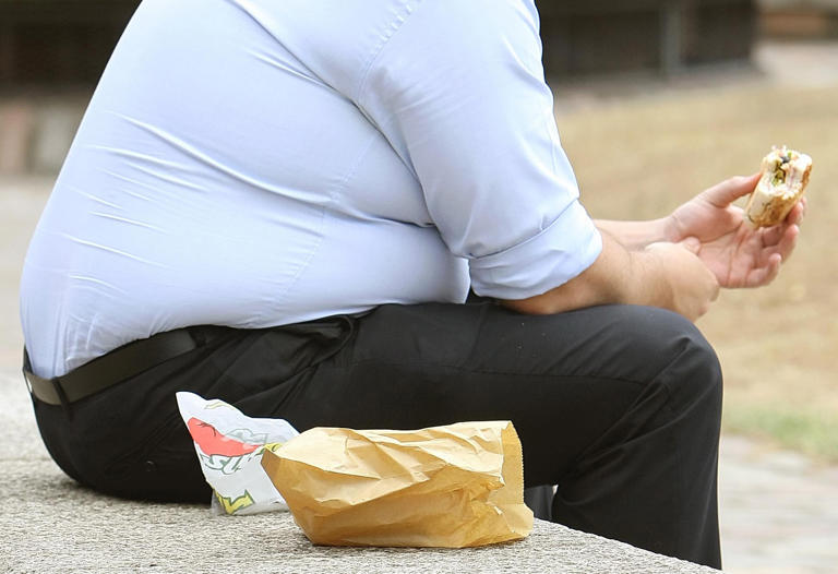 Obesity admissions in Lincolnshire rise by nearly a fifth over the last year