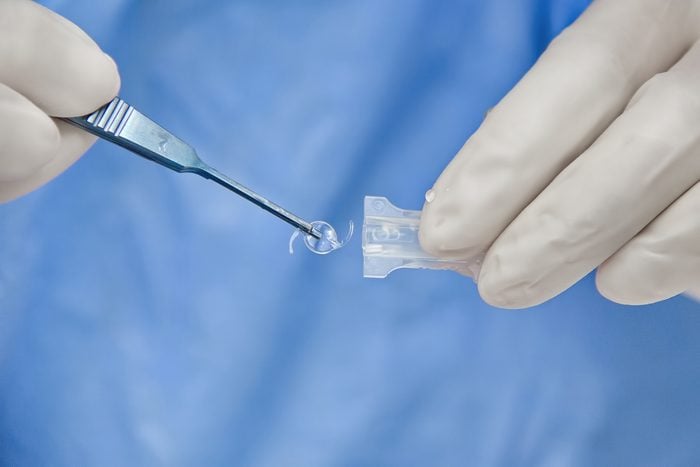 Iol Intraocular Lens Cataract Ophthalmology