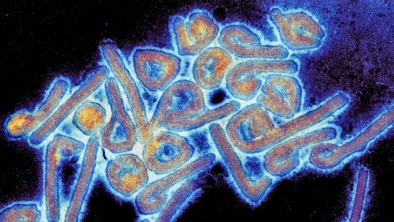 El Virus de Marburgo visto desde el microscopio, el cual puede ser mortal. Foto: Universidad de Texas