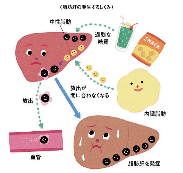 日本人の3分の1が脂肪肝という時代、肝臓をケアして痩せ体質になる生活習慣7カ条。