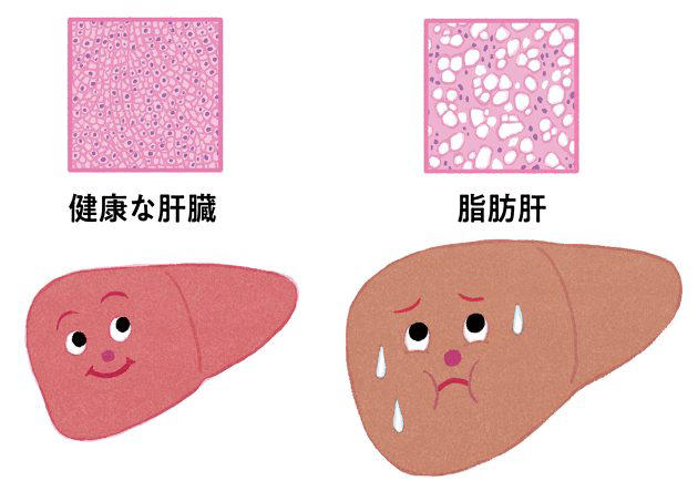 日本人の3分の1が脂肪肝という時代、肝臓をケアして痩せ体質になる生活習慣7カ条。