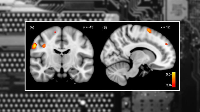 Quanti gigabyte di memoria ha il cervello umano?