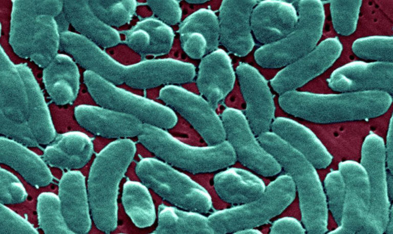 6 Florida counties saw ‘unusual increase’ in flesh-eating bacteria ...