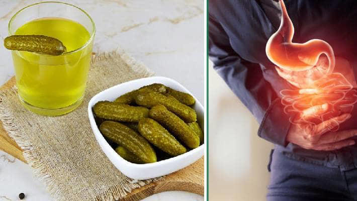 Health benefits of pickle juice best sale