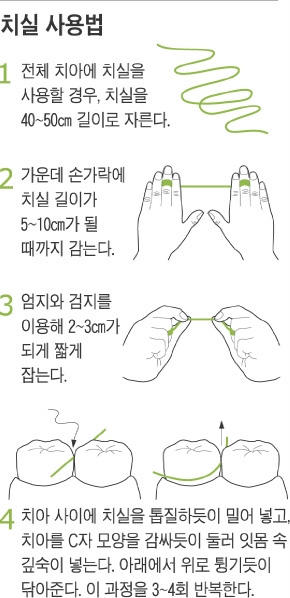 치실 꼭 써야 하지만… ‘이때’ 사용하면 효과 적다