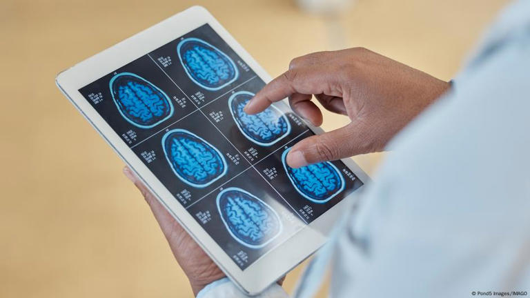 Identifican el 'punto caliente' del cerebro que controla el proceso de